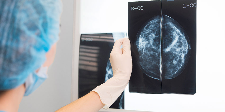 Methodist Healthcare describes treatment and surgery options for patients diagnosed with breast cancer.