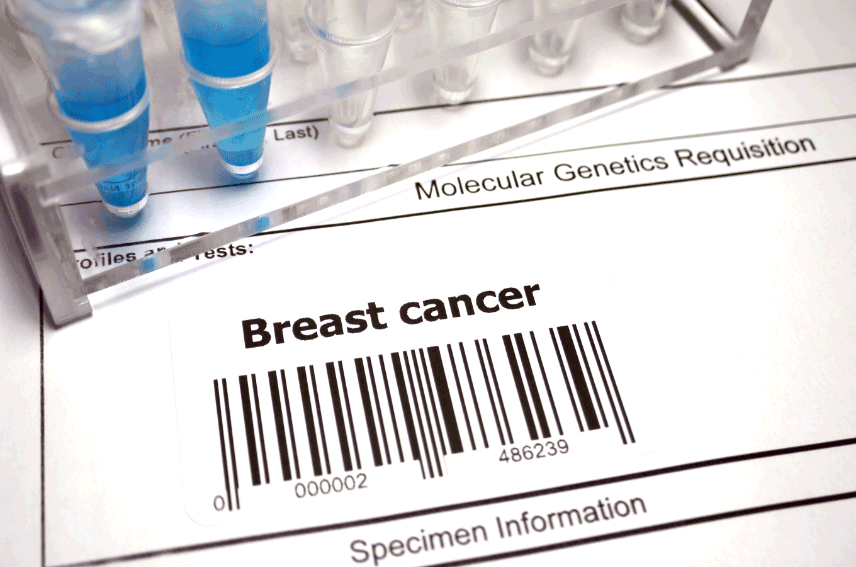 Methodist Healthcare System provides a description of breast cancer genetic testing.
