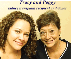 tracy and peggy kidney transplant recipient and donor